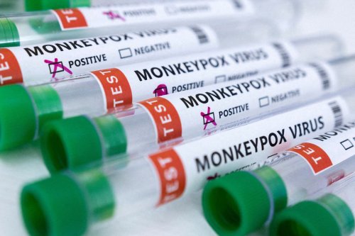 Why is the monkeypox vaccine only being offered to men?