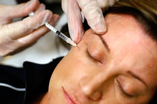 Botox? No thanks – I’d rather look old than look weird