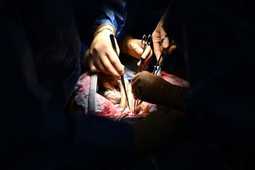 Patients treated by female surgeons ‘less likely to experience death,’ research finds