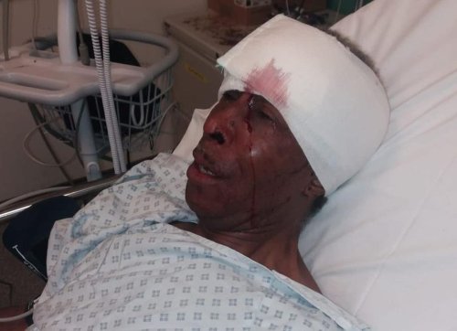 Police watchdog probes arrest of Black driver, 70, left in hospital