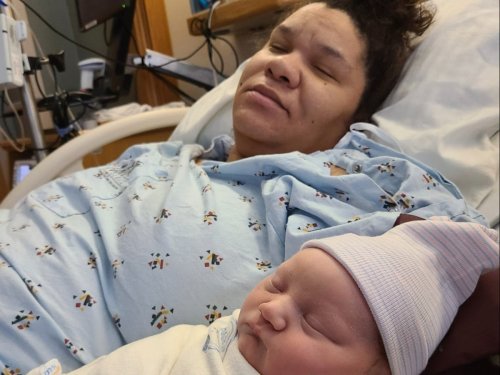 Woman goes viral getting extreme ‘pregnancy nose’