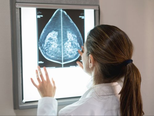 Women unaware of important sign that indicates increased breast cancer risk, study finds