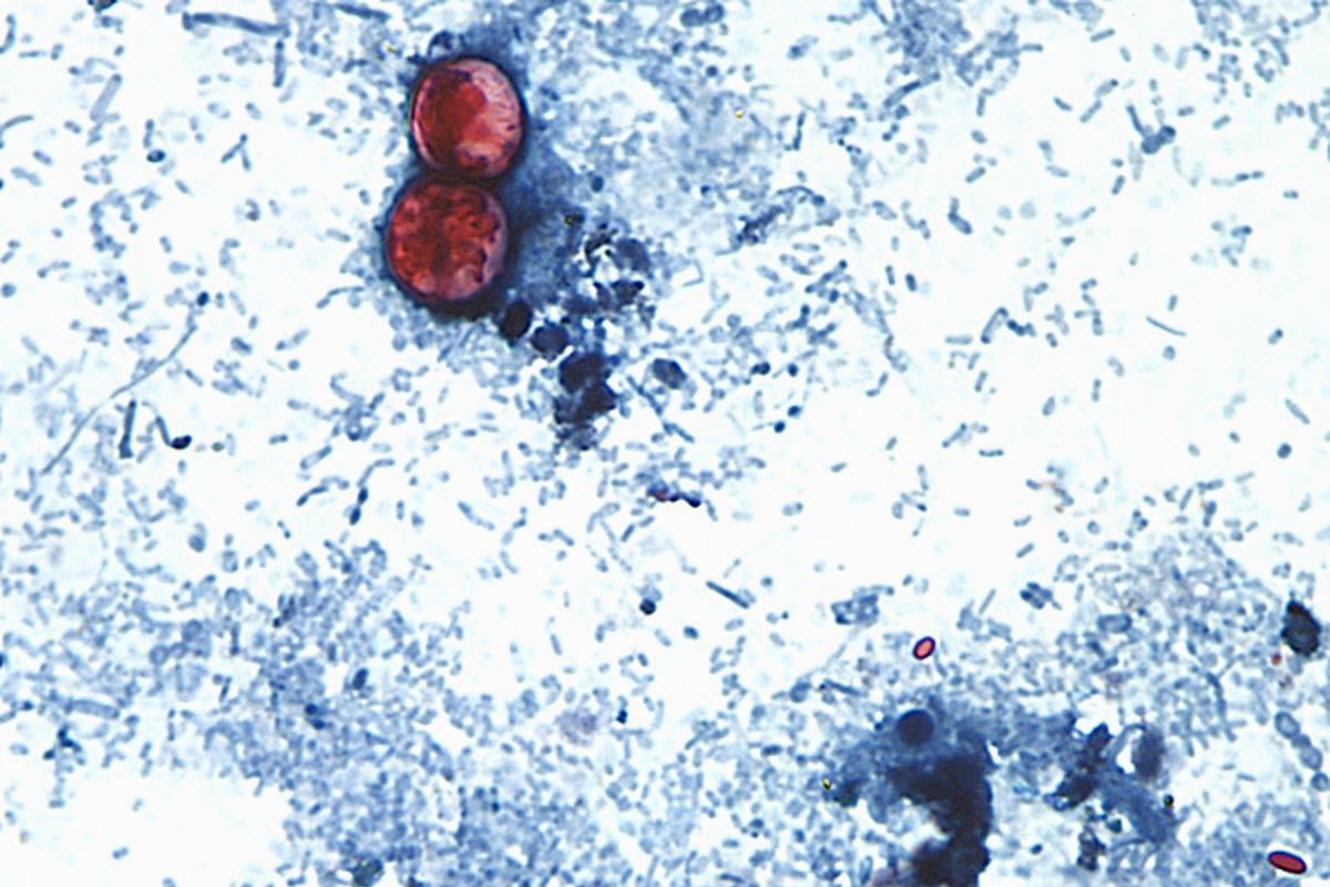 Cyclospora: Explosive diarrhoea infection spreads to UK as officials issue holiday warning