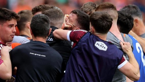 GAA set to launch probe into gouging claims after Galway and Armagh clash