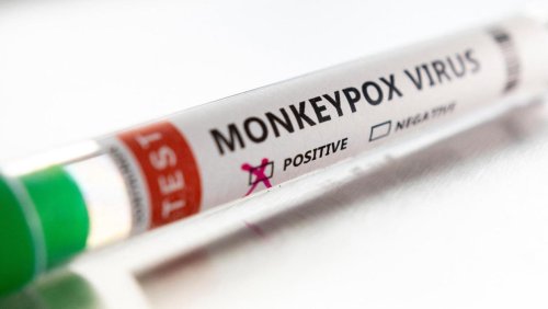 First case of monkeypox virus confirmed in east of Ireland