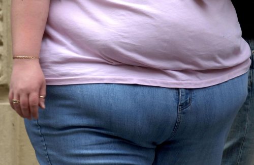 Obesity policies over last 30 years were 'destined to fail' say Cambridge researchers