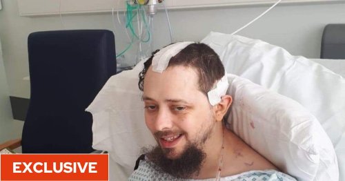 AstraZeneca vaccine legal fight: ‘Doctors had to remove part of my skull because of the pressure on my brain’