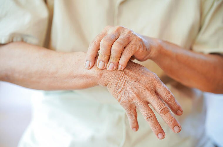 Mit Kurkuma gegen Schmerzen: Natürliche Mittel bei Arthrose