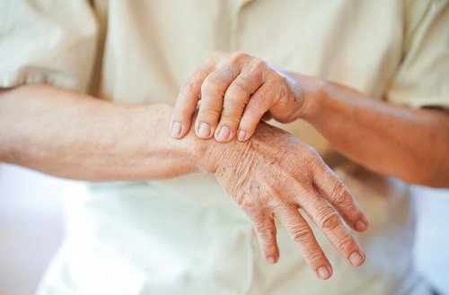 Mit Kurkuma gegen Schmerzen: Natürliche Mittel bei Arthrose