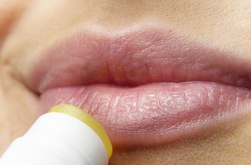 Rissige Lippen, trockene Haut: So pflegst du deinen Körper im Herbst und Winter