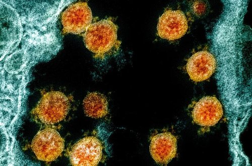 Neue Corona-Variante "Arcturus" breitet sich rasant aus: Zuerst Indien und jetzt auch Bayern in Deutschland