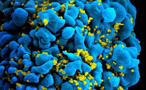 Researchers identify antibody that kills 98% of HIV strains