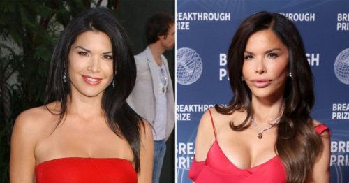 The Internet’s Baffled—Why Does Lauren Sánchez’s Surgery Look So Cheap for a Billionaire’s Bride?