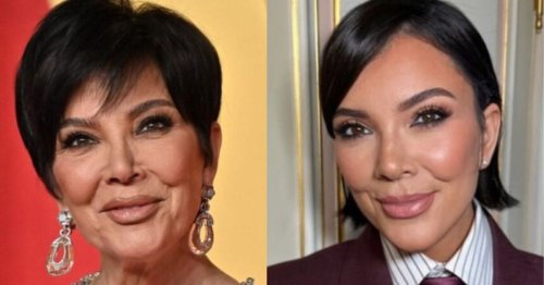 Kris Jenner’s Face Has the Internet Screaming ‘Plastic Surgery!’—Experts Say It’s a Full Rebuild