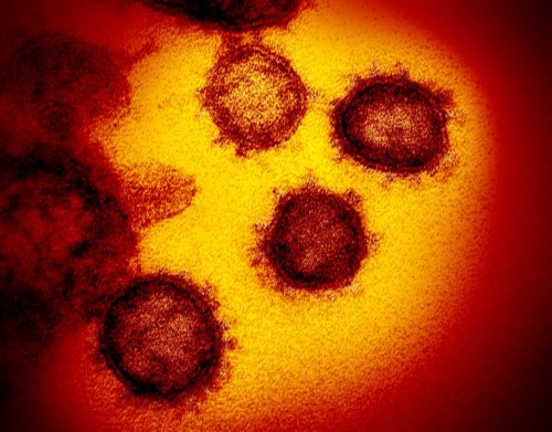 Long COVID: The Persistence of SARS-CoV-2 in the Mucous Membranes May Be A Factor - Inserm Newsroom