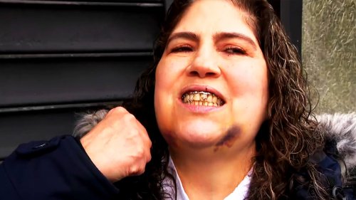 Woman Says She Lost 3 Teeth After Stranger Punched Her as More Women Come Forward About Attacks by Men in NYC
