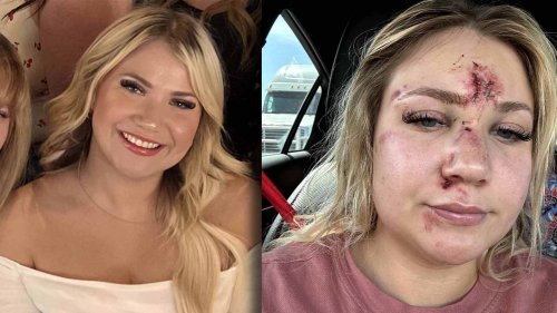 Bride-to-Be Sucker-Punched at Her Bachelorette Party