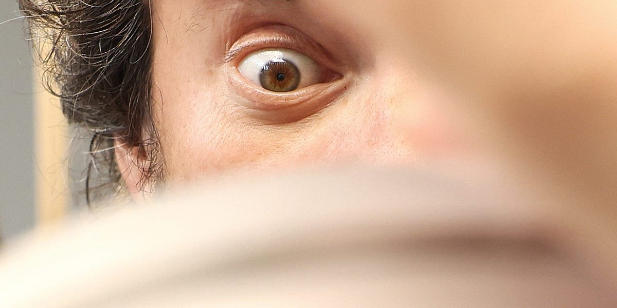 Sam Altman's eye-scanning startup is laying off employees