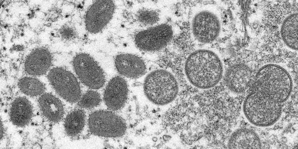 Here's how the US handled its first-ever monkeypox outbreak that infected dozens of people across several states