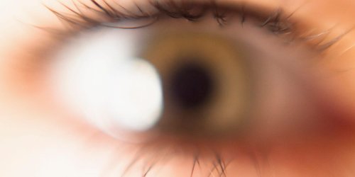 Spots in your vision? Why you have eye floaters and what to do about them