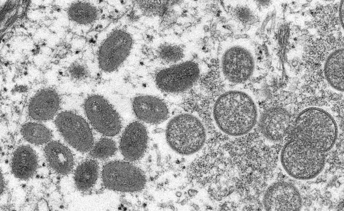 Here's how the US handled its first-ever monkeypox outbreak that infected dozens of people across several states