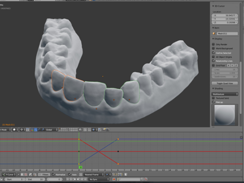 This guy fixed his teeth by 3D printing his own plastic braces for $60