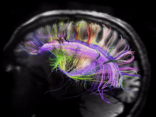 Harvard scientists think they've pinpointed the physical source of consciousness