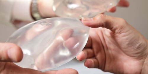 My boyfriend paid for my breast implants, but I paid the price in more ways than one
