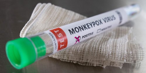 Only 1 in 3 Americans believe COVID-19 is a bigger public health threat than monkeypox: poll
