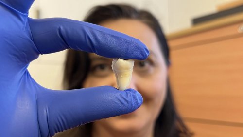 Lab-grown teeth may soon replace fillings and dental implants