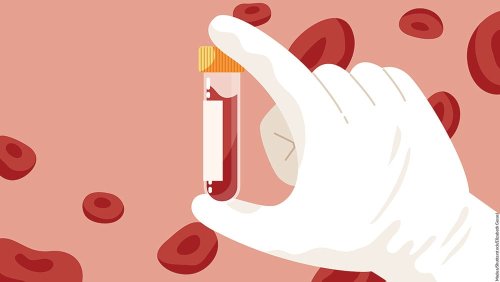 The Blood Test Revolution Driving These Three Stocks