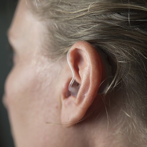 The Lyric Invisible Hearing Aid Revisted