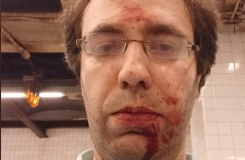 'If I had a gun I'd shoot you' - Jewish man punched on NYC subway