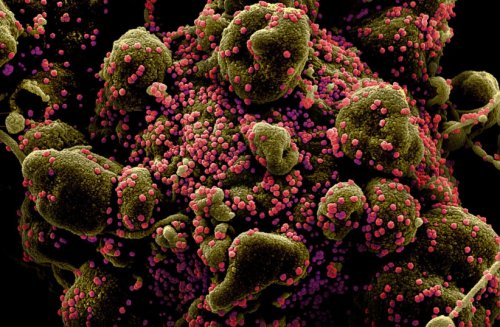 Coronavirus: Contagious Brazil variant evades immunity - scientists