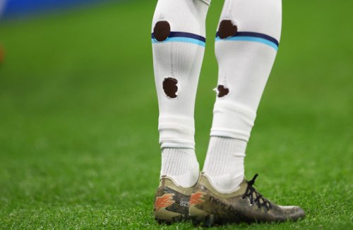 Qatar World Cup: Why do soccer players have holes in their socks?