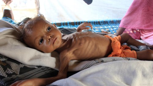 UNO-Bericht: Zahl der Hungernden weltweit deutlich gestiegen