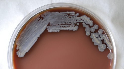 CDC Warns Doctors About a Mystery Bacterial Outbreak With No Clear Origin
