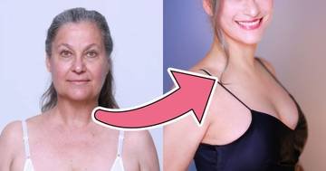 57-Year-Old American Woman Looks Decades Younger After Jaw-Dropping Plastic Surgery Transformation In Korea