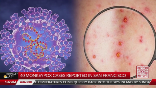 SF monkeypox cases double in a week
