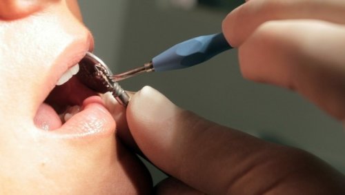 Zahnarzt angeklagt: Missbrauch als „Morgenritual“