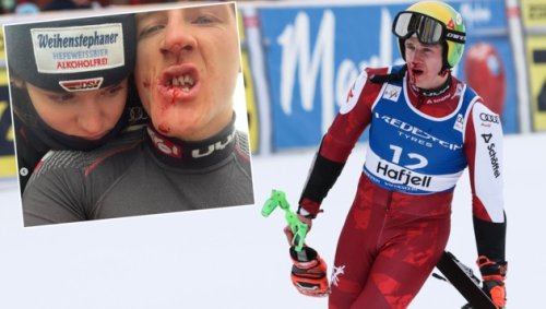 Freundin zeigt blutige Zähne von Haaser