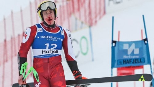 Zähne raus! Haaser spricht über Marathon-Operation