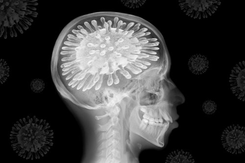 Post-COVID ‘brain fog’ could be result of virus changing patients’ spinal fluid
