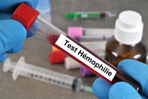 Journée mondiale de l’hémophilie : les symptômes féminins toujours mal reconnus