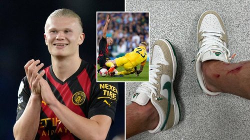 Erling Haaland Shows Off Injuries From Brighton Game, He Was In The ...