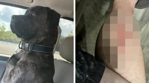 Dog that bit owner's leg turned out to be 'saving his life'