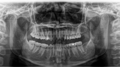 Dentist reveals red-flag signs of oral cancer that can be spotted without even looking inside your mouth