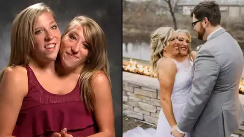 People all asking the same thing after conjoined twin Abby Hensel's marriage is revealed