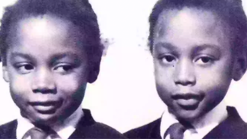 Disturbing facts about twins who made pact that one must die so the other could live a normal life