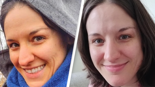 Before and after photo of woman with carotenosis reveals shocking impact of eating carrots every day